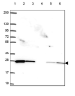 RAB11A Antibody in Western Blot (WB)