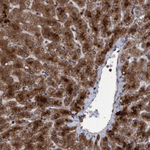 PSMB6 Polyclonal Antibody