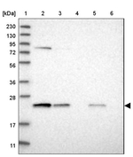 PSMB6 Antibody in Western Blot (WB)