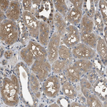 RhoGDI Polyclonal Antibody