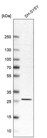 RhoGDI Antibody in Western Blot (WB)