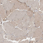 AKT3 Antibody in Immunohistochemistry (Paraffin) (IHC (P))