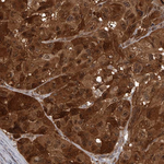 AKT3 Antibody in Immunohistochemistry (Paraffin) (IHC (P))