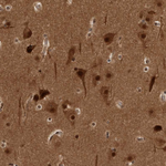 AKT3 Antibody in Immunohistochemistry (Paraffin) (IHC (P))