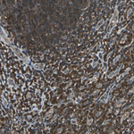 PSME1 Polyclonal Antibody