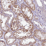 ALDH2 Antibody in Immunohistochemistry (Paraffin) (IHC (P))