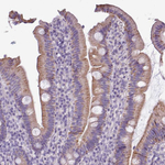 ALDH2 Polyclonal Antibody