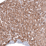 ALDH2 Antibody in Immunohistochemistry (Paraffin) (IHC (P))