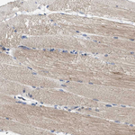 TRAF6 Antibody in Immunohistochemistry (Paraffin) (IHC (P))