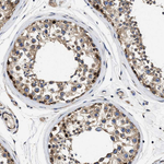 TRAF6 Antibody in Immunohistochemistry (Paraffin) (IHC (P))