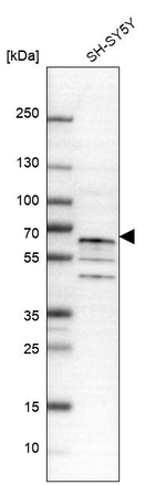TRAF6 Antibody in Western Blot (WB)