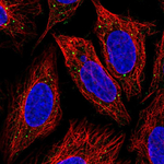 IRAK-M Antibody in Immunocytochemistry (ICC/IF)