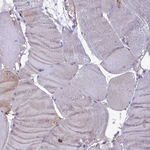 IRAK-M Antibody in Immunohistochemistry (Paraffin) (IHC (P))