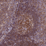 IRAK-M Antibody in Immunohistochemistry (Paraffin) (IHC (P))