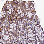 IRAK-M Antibody in Immunohistochemistry (Paraffin) (IHC (P))