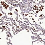 IRAK-M Antibody in Immunohistochemistry (Paraffin) (IHC (P))
