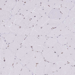 RIP140 Antibody in Immunohistochemistry (Paraffin) (IHC (P))