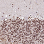RIP140 Antibody in Immunohistochemistry (Paraffin) (IHC (P))
