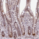 RIP140 Antibody in Immunohistochemistry (Paraffin) (IHC (P))
