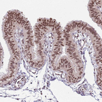 RIP140 Antibody in Immunohistochemistry (Paraffin) (IHC (P))
