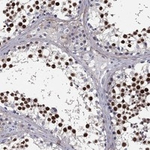 LOC81691 Polyclonal Antibody