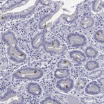 GNAT3 Polyclonal Antibody
