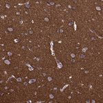 Syntaxin 1 Polyclonal Antibody