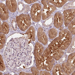 Cyclophilin A Antibody in Immunohistochemistry (Paraffin) (IHC (P))
