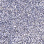 ITGB5 Antibody in Immunohistochemistry (Paraffin) (IHC (P))