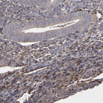 ITGB5 Antibody in Immunohistochemistry (Paraffin) (IHC (P))