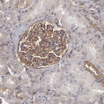 ITGB5 Antibody in Immunohistochemistry (Paraffin) (IHC (P))