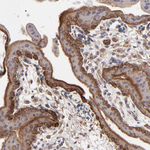 ITGB5 Antibody in Immunohistochemistry (Paraffin) (IHC (P))