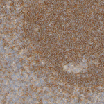 APPL1 Polyclonal Antibody