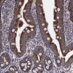 ATGL Polyclonal Antibody