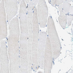 CD226 Antibody in Immunohistochemistry (Paraffin) (IHC (P))