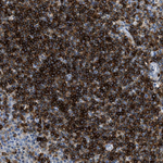 CD226 Antibody in Immunohistochemistry (Paraffin) (IHC (P))