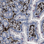 CD226 Antibody in Immunohistochemistry (Paraffin) (IHC (P))