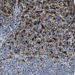 BMPR2 Polyclonal Antibody