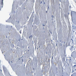 TRAF6 Antibody in Immunohistochemistry (Paraffin) (IHC (P))