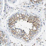 TRAF6 Antibody in Immunohistochemistry (Paraffin) (IHC (P))