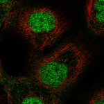 ETS2 Polyclonal Antibody