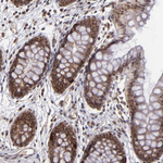 p300 Antibody in Immunohistochemistry (Paraffin) (IHC (P))