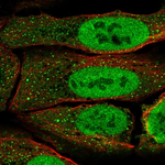 PAX5 Polyclonal Antibody