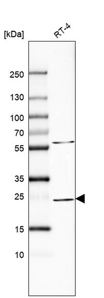 RAB11A Antibody in Western Blot (WB)