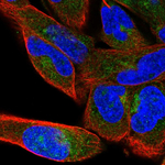 beta COP Antibody in Immunocytochemistry (ICC/IF)