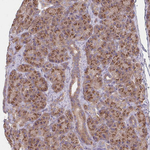 beta COP Antibody in Immunohistochemistry (Paraffin) (IHC (P))