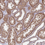 beta COP Antibody in Immunohistochemistry (Paraffin) (IHC (P))