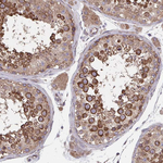 beta COP Antibody in Immunohistochemistry (Paraffin) (IHC (P))