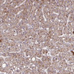 beta COP Antibody in Immunohistochemistry (Paraffin) (IHC (P))