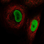 PRMT1 Antibody in Immunocytochemistry (ICC/IF)